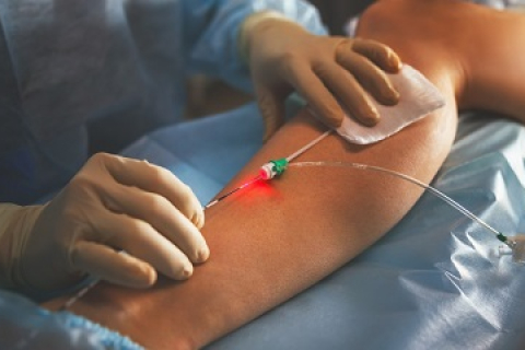 Лечим вены по полису ДМС!