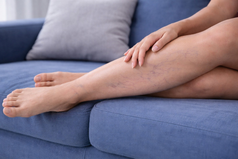 Можно ли полностью убрать сосудистые звездочки